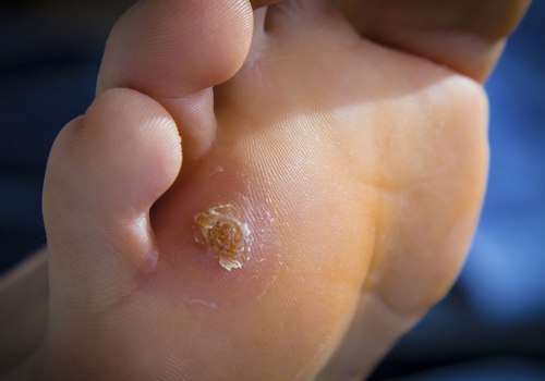 7 Common Foot Problems and How to Treat Them: An Expert's Perspective