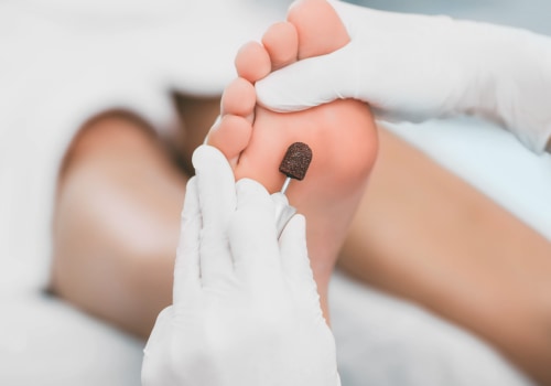 The Distinction Between a Foot Specialist and a Podiatrist: An Expert's Perspective