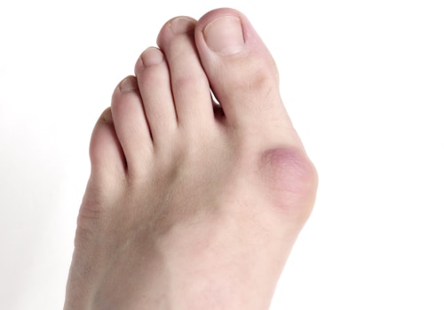 The Most Common and Painful Foot Conditions: Causes, Symptoms, and Treatment